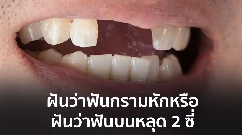 ฝันว่าฟันบนหลุด 2 ซี่