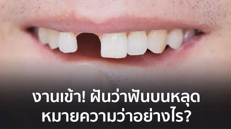 ฝันว่าฟันบนหลุดหมดปาก